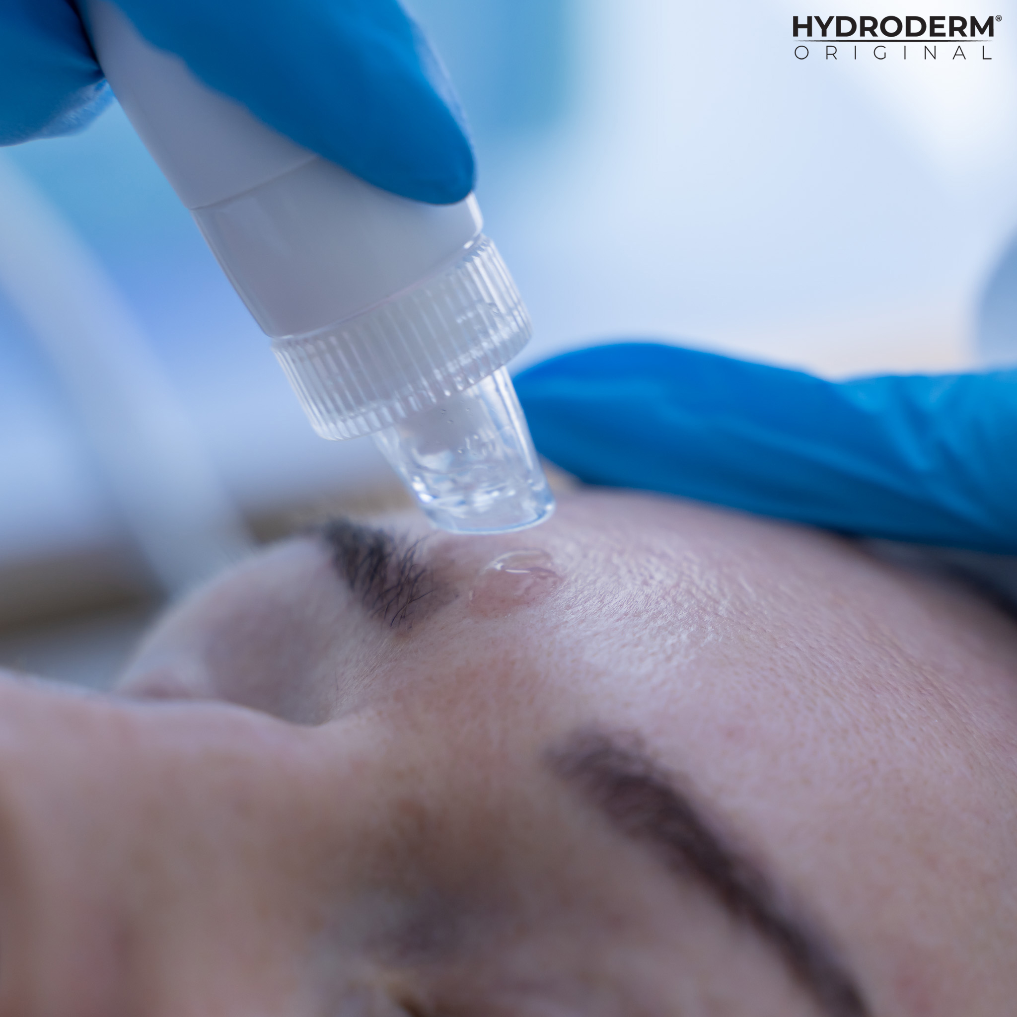 Dzięki wielofunkcyjności urządzenia Hydroderm można wykonywać nim terapie łączone.