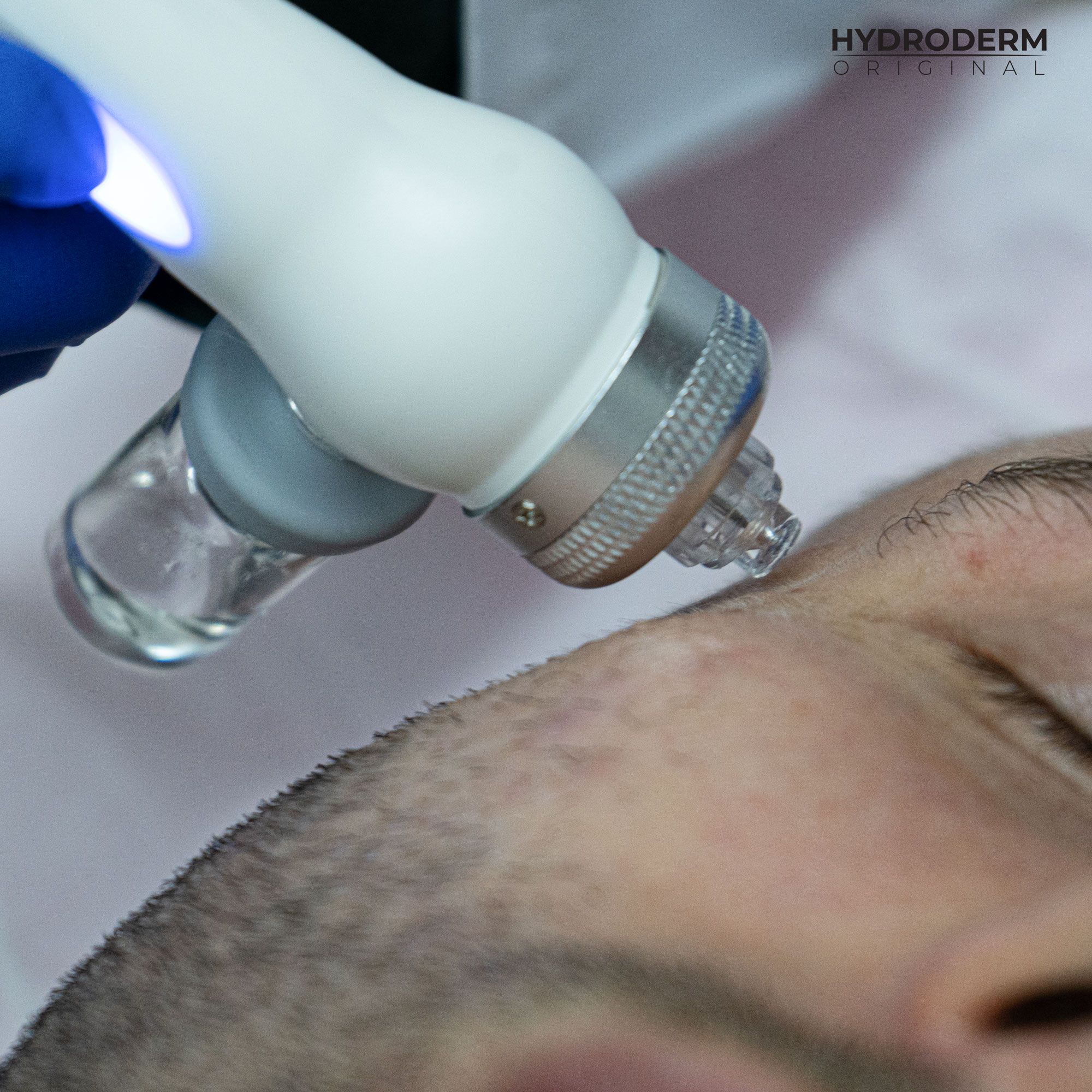 Składniki aktywne są wprowadzane w głąb skóry przy użyciu głowicy Oxygen Spray