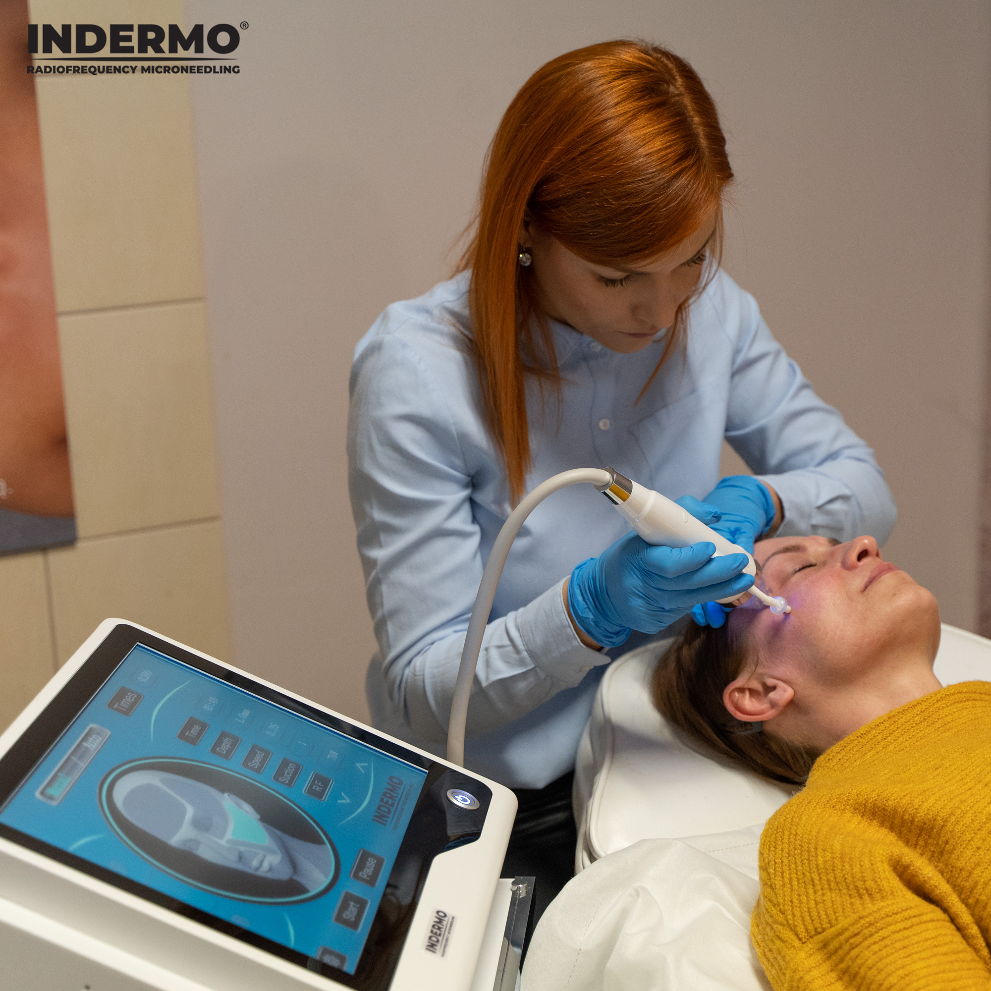Maszyna Indermo Radiofrequency Microneedling wyróżnia się na rynku kosmetologicznym manualnym i automatycznym trybem zabiegowym