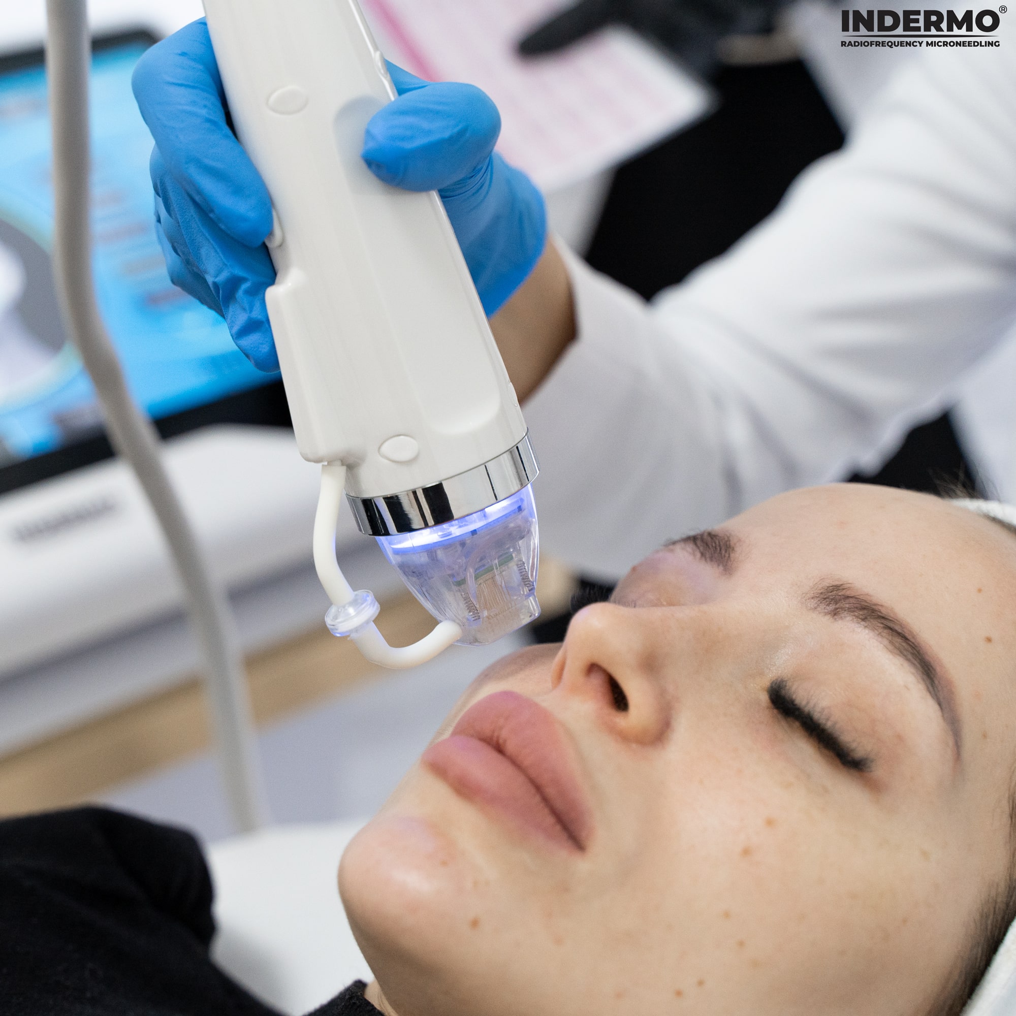 Kosmetolog instruuje uczestniczkę jak regulować funkcję podciśnienia, by wykonać zabieg na trudno dostępnych partiach twarzy