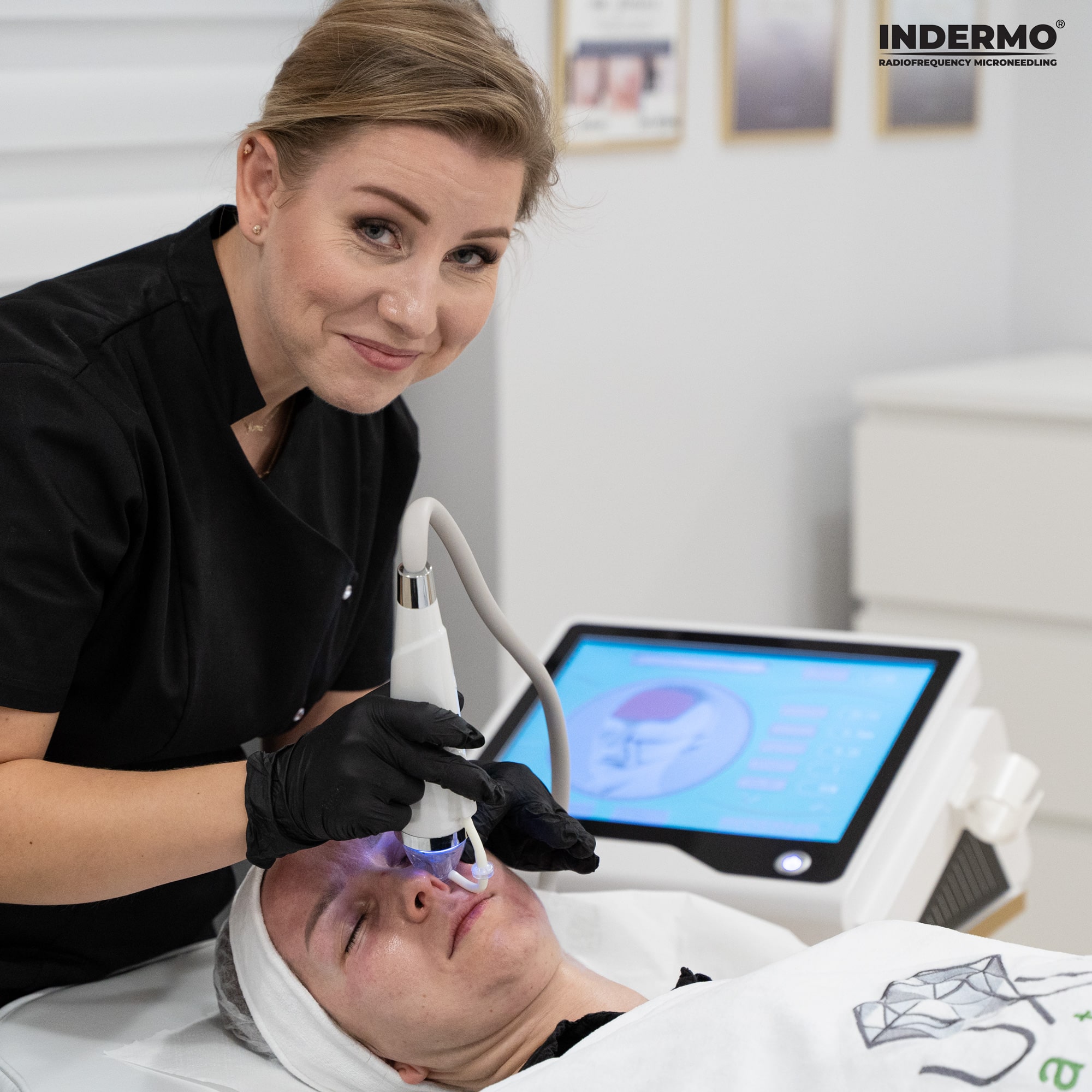 Według instrukcji kosmetologa uczestniczka wykorzystuje synergię działania trzech technologii - radiofrekwencji, mikronakłuwania i podciśnienia