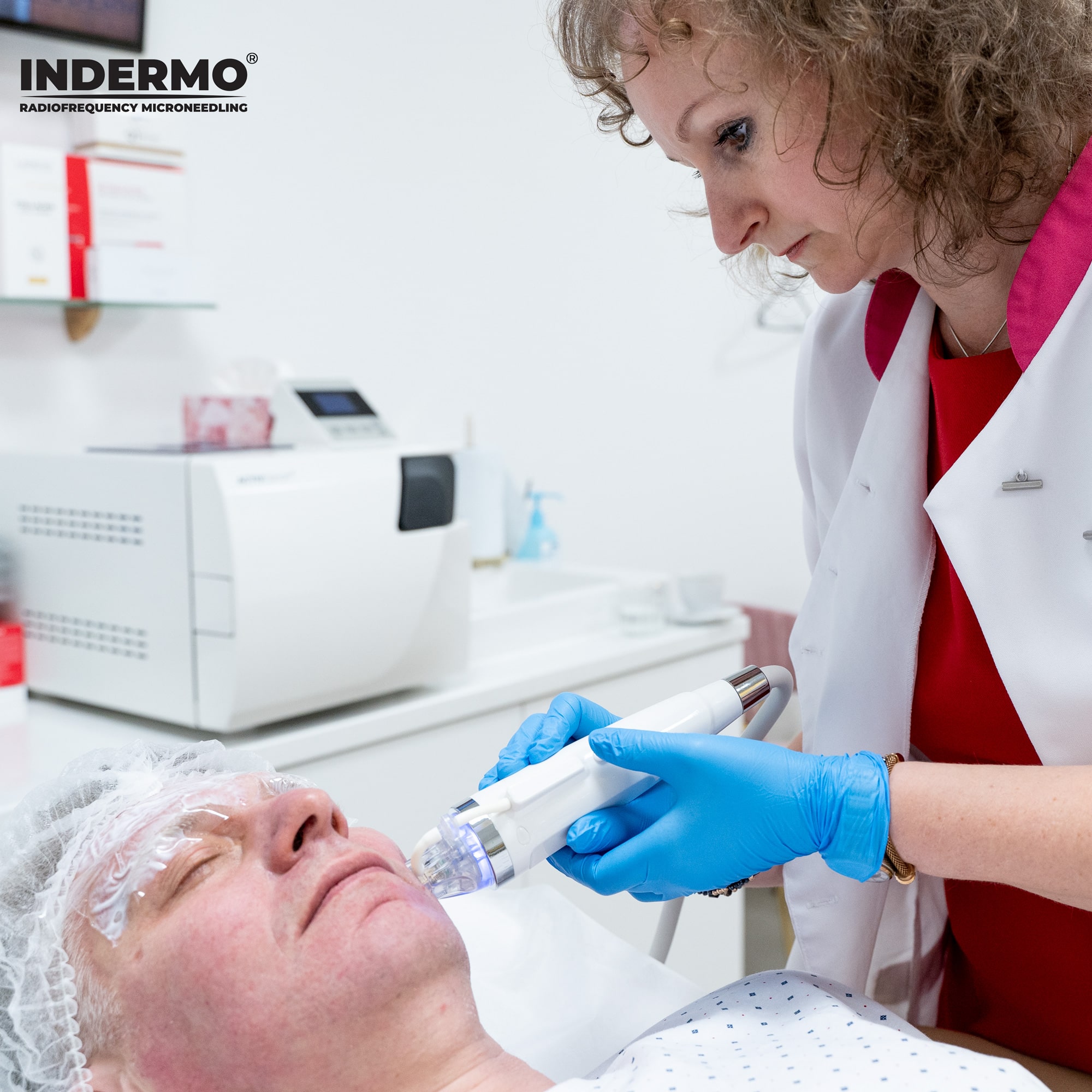 Frakcyjna radiofrekwencja mikroigłowa bardzo często jest wykorzystywana przez kosmetologów do nieinwazyjnego odmładzania skóry