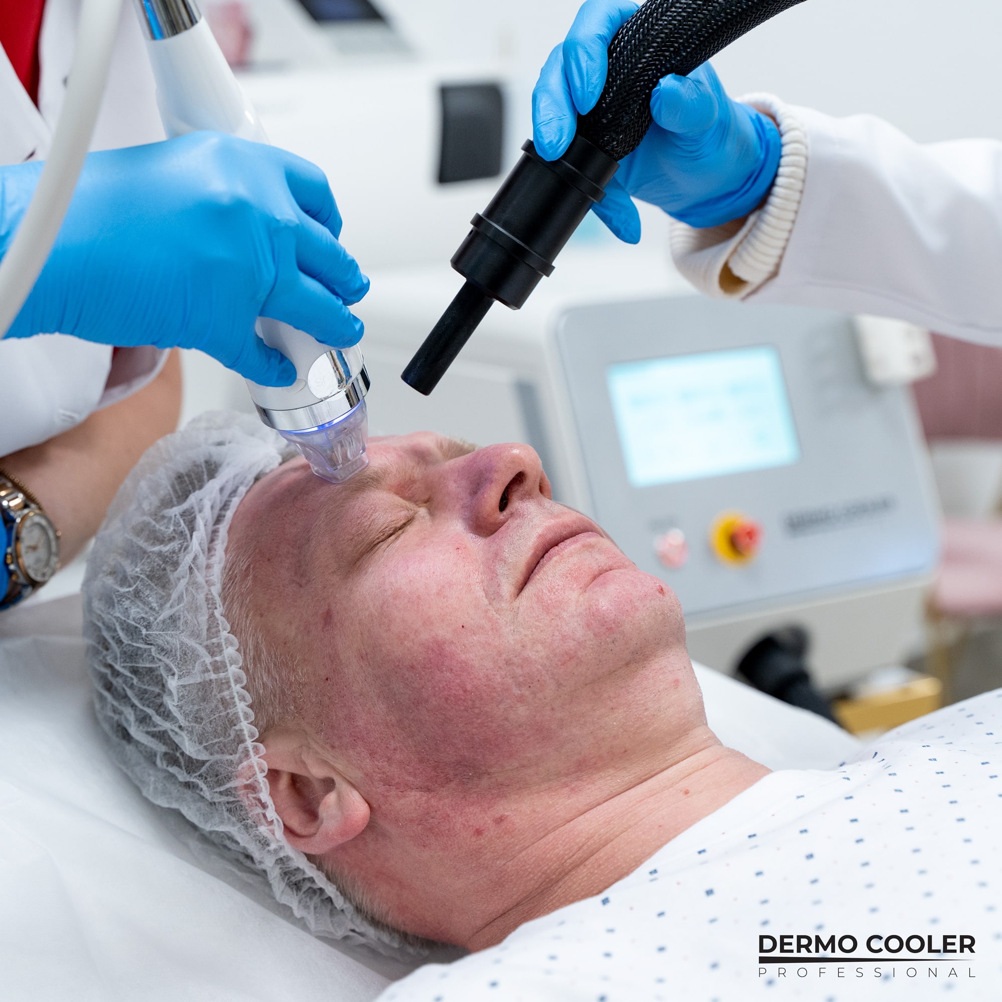 System chłodzenia skóry podnosi komfort pacjenta podczas dowolnego zabiegu kosmetologicznego