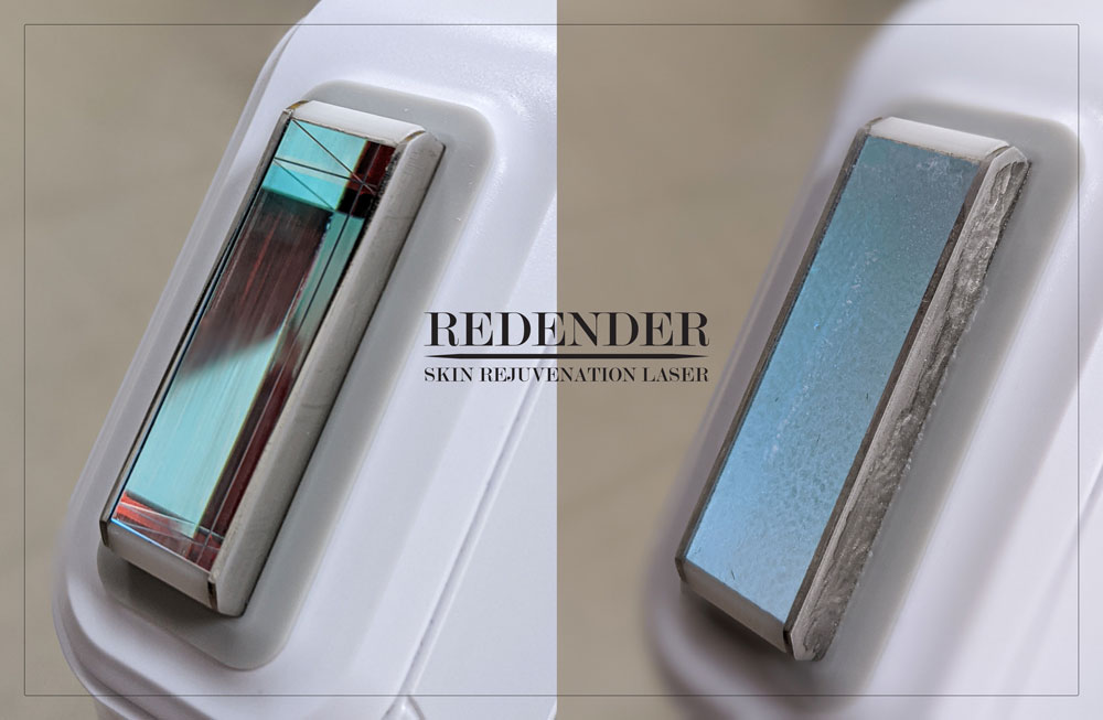 Laser multifunkcyjny Redender potrafi schłodzić skórę aż do -20 stopni