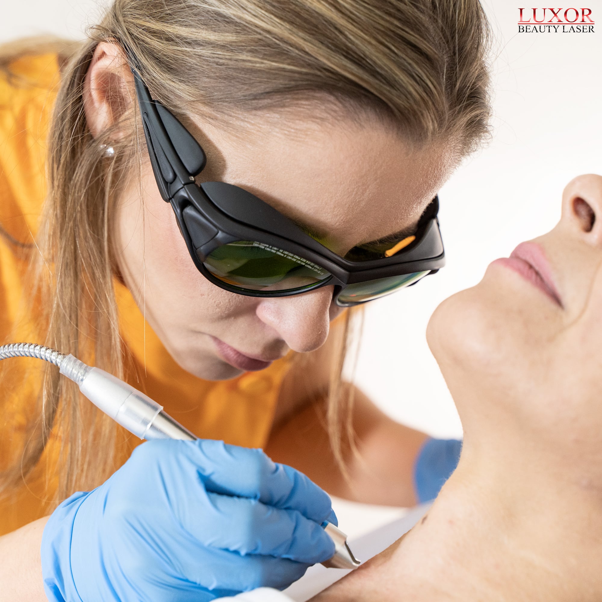 Nasze szkolenie obejmuje także procedurę usuwania rozszerzeń na twarzy - teleangiektazje