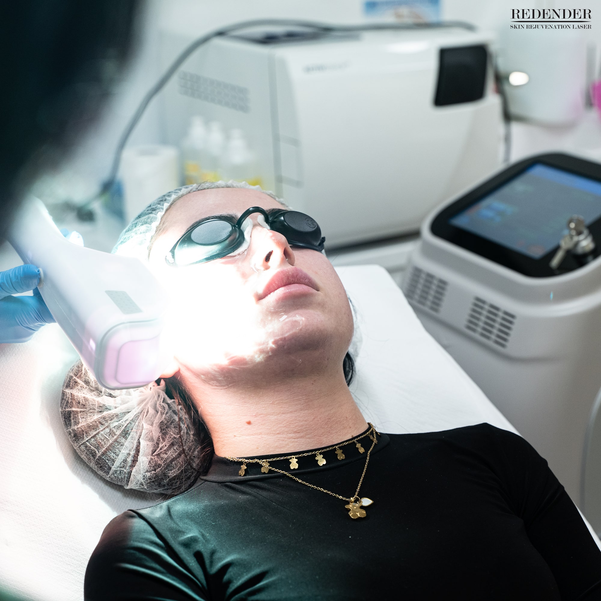 Nasze urządzenie Redender pozwala przeprowadzić terapię przeciwdziałającą procesom starzenia się skóry